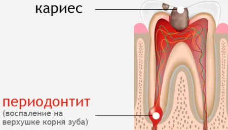 Зубы: истории из жизни, советы, новости, юмор и картинки — Все посты | Пикабу